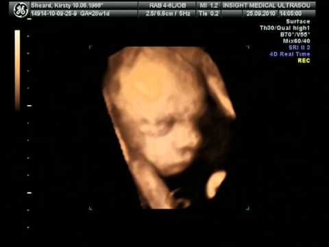 Ruby » The 4D Scan Of Our Baby Daughter - Ruby Grace